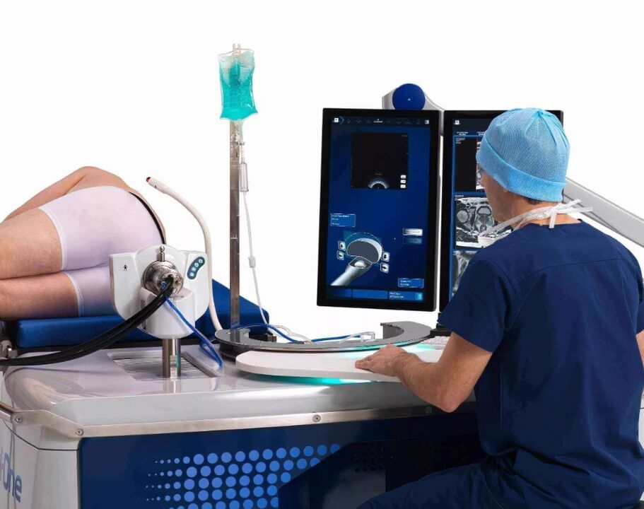 An ultrasound examination of the prostate gland